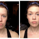 Madeleine before, after.